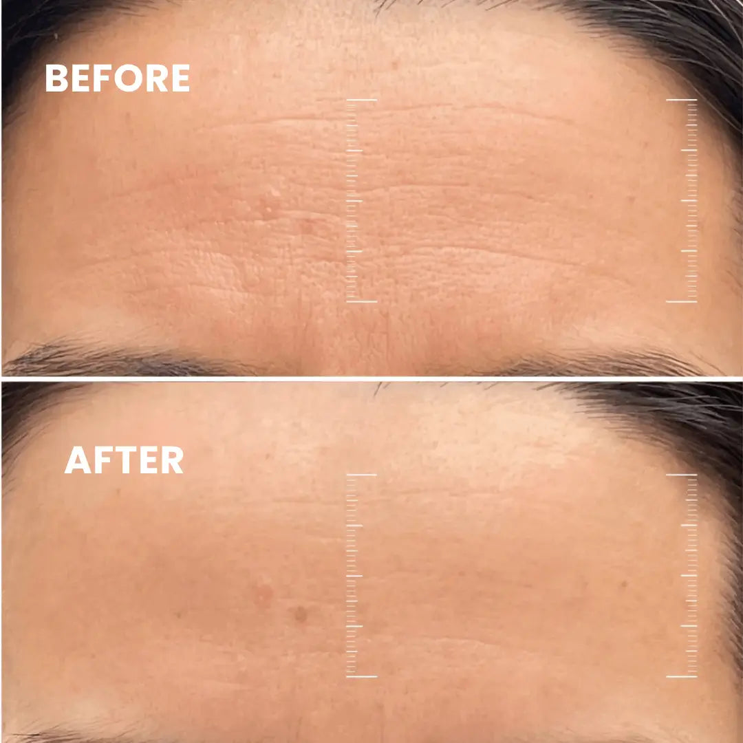 HOYGI Collagen-Boosting Night Mask | Visibly younger skin in just 7 days!
